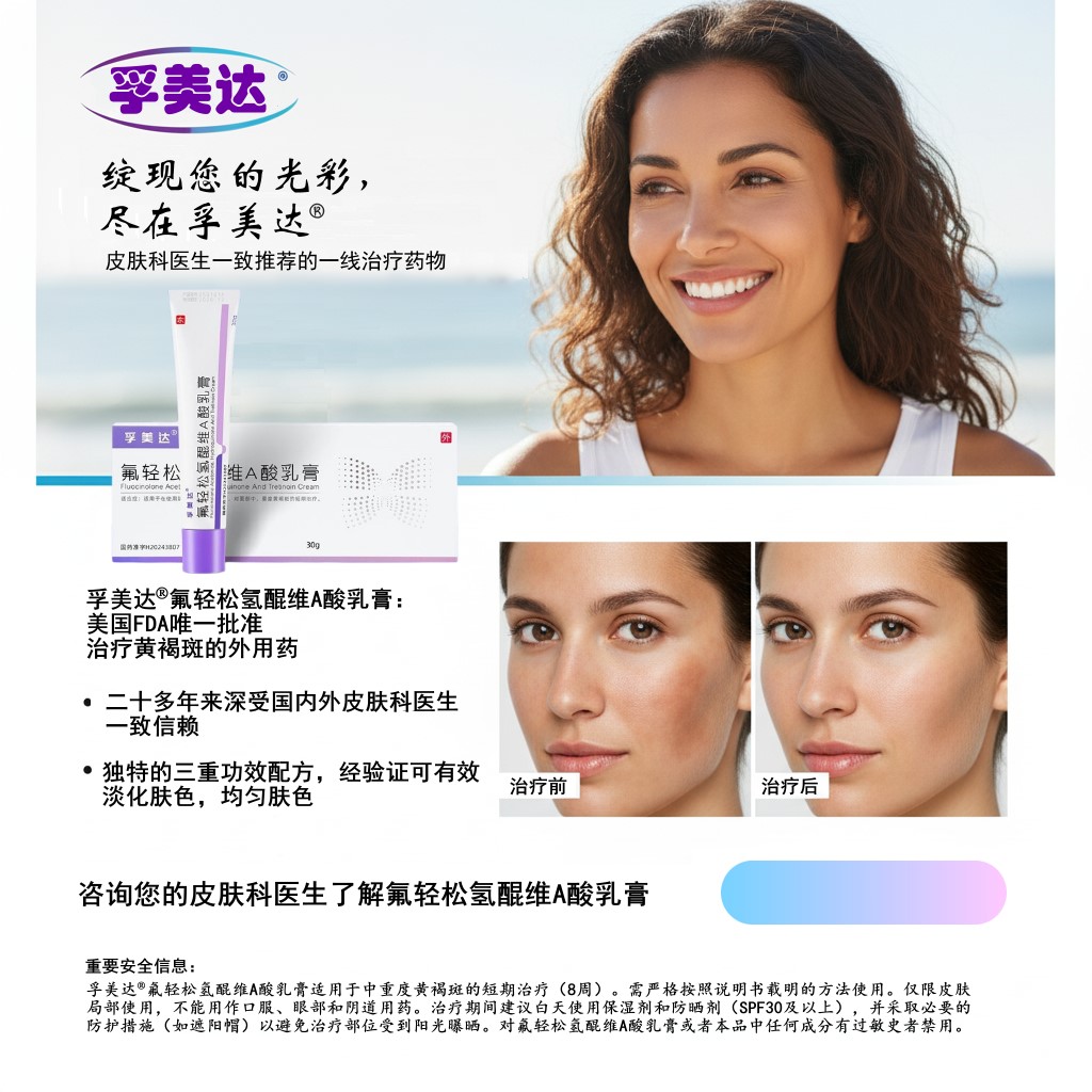 黃褐斑治療的金標準-氟輕松氫醌維A酸乳膏